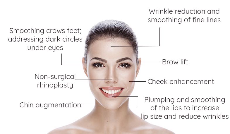 Dermal Fillers for lip, cheeks, eyes, chin and smile lines. Anti ageing fillers use an injectable gel to improve the skin